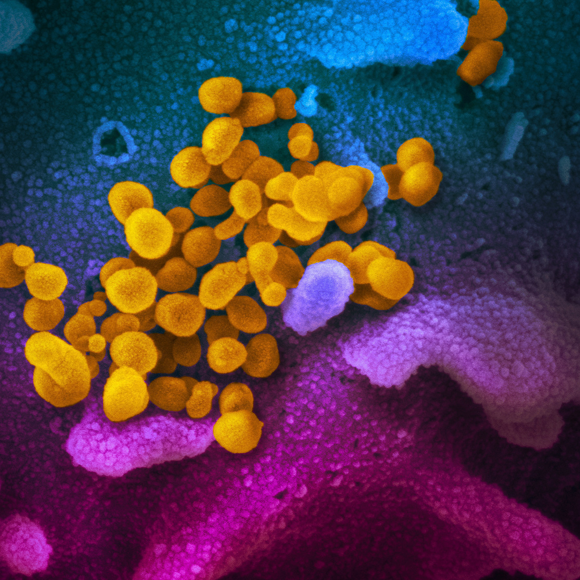 What we know about how the coronavirus works